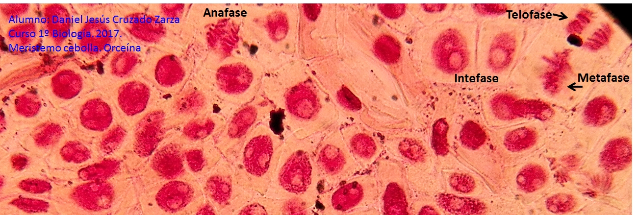 Mitosis2