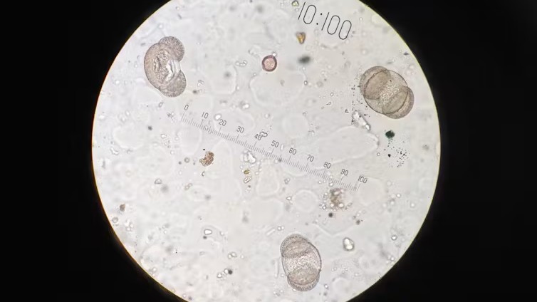 Imagen de microscopio con polen entre otras partículas